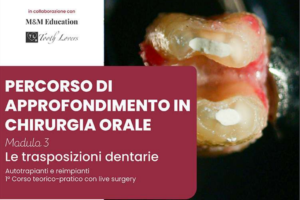 Immagine4 Immagine4